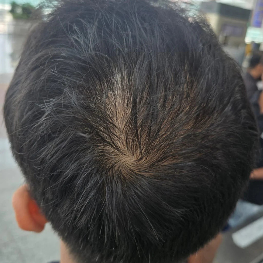 After